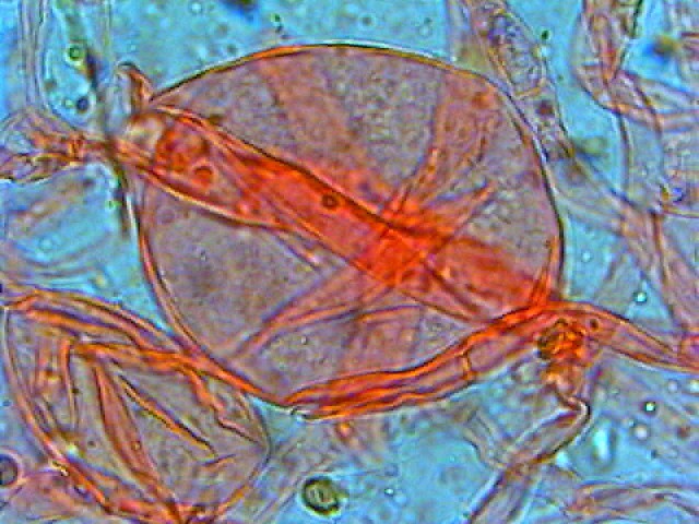 Amanita umbrinolutea